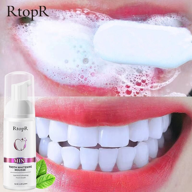 Tooth Whitening Mousse - Beautiful You Store, LLC