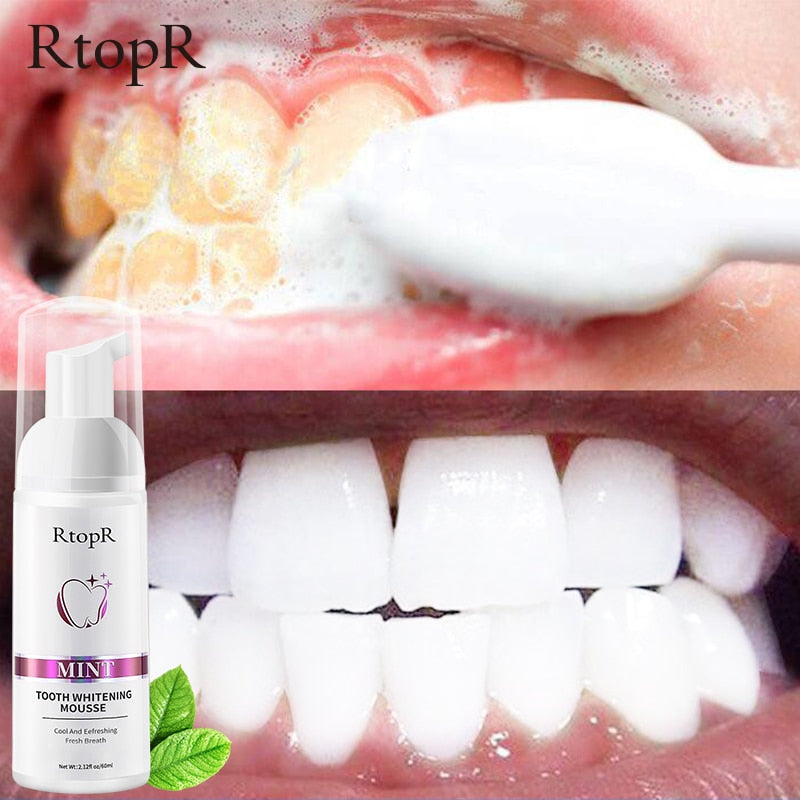 Tooth Whitening Mousse - Beautiful You Store, LLC