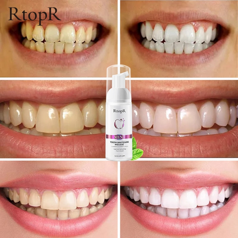 Tooth Whitening Mousse - Beautiful You Store, LLC