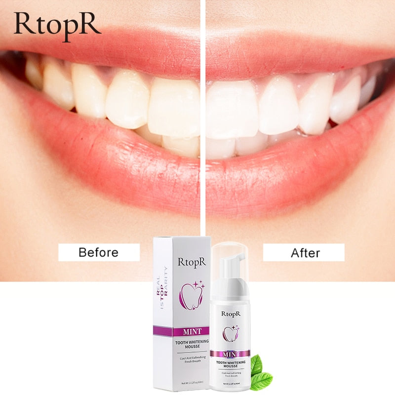 Tooth Whitening Mousse - Beautiful You Store, LLC