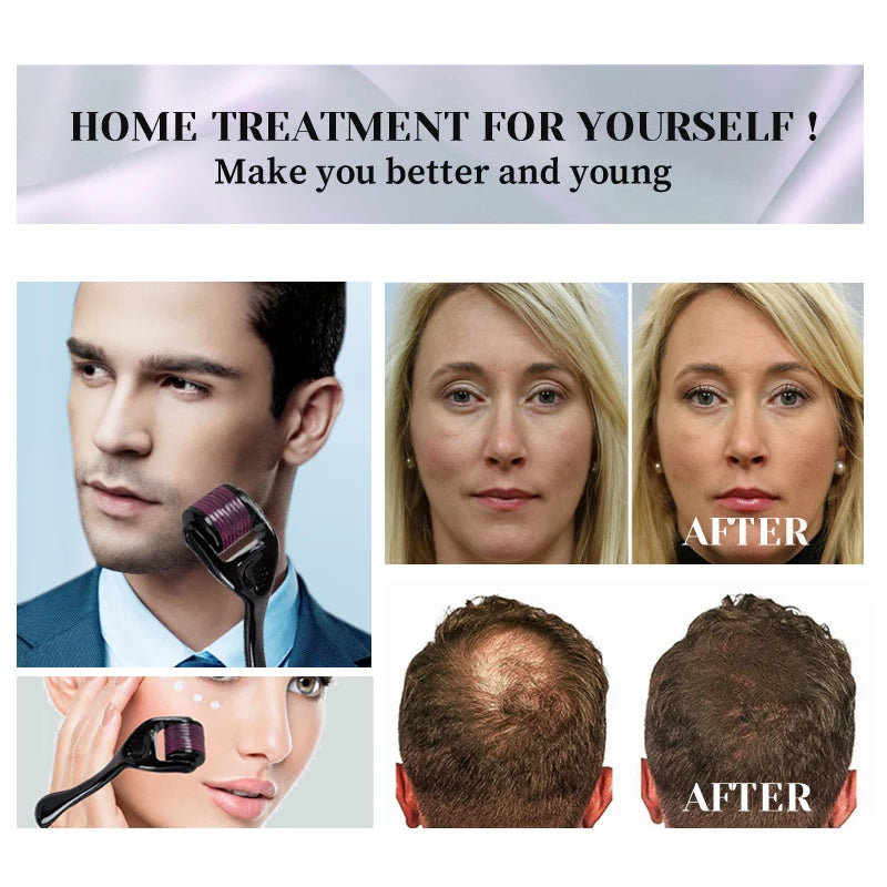 Roller for Hair Growth Skin Care Tool - Beautiful You Store, LLC